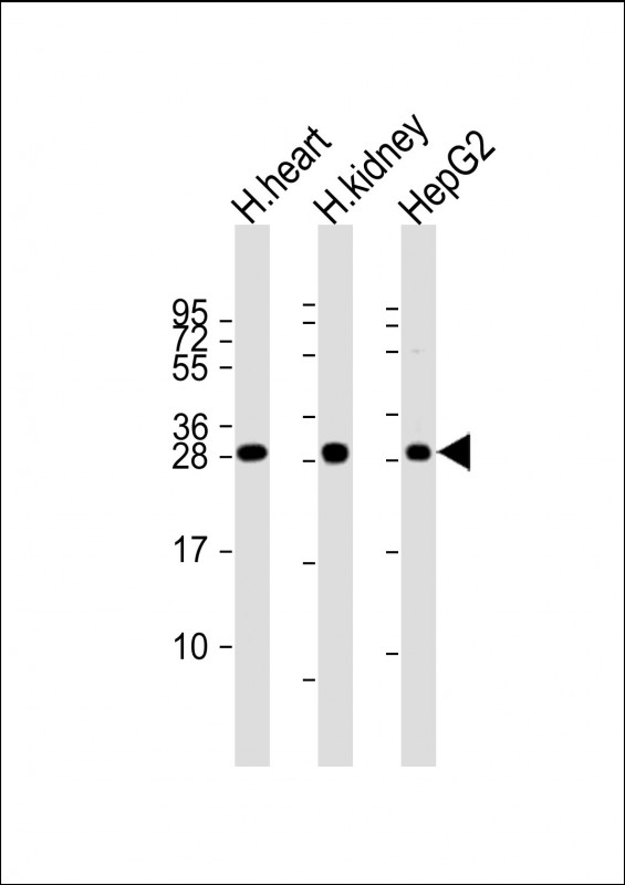 WB - AK2 Antibody (C-term) AP8134b